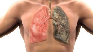 Sigaranın Sağlığa Zararları