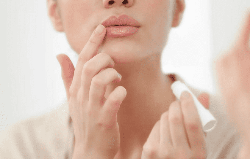 Çatlak dudaklar nasıl tedavi edilir